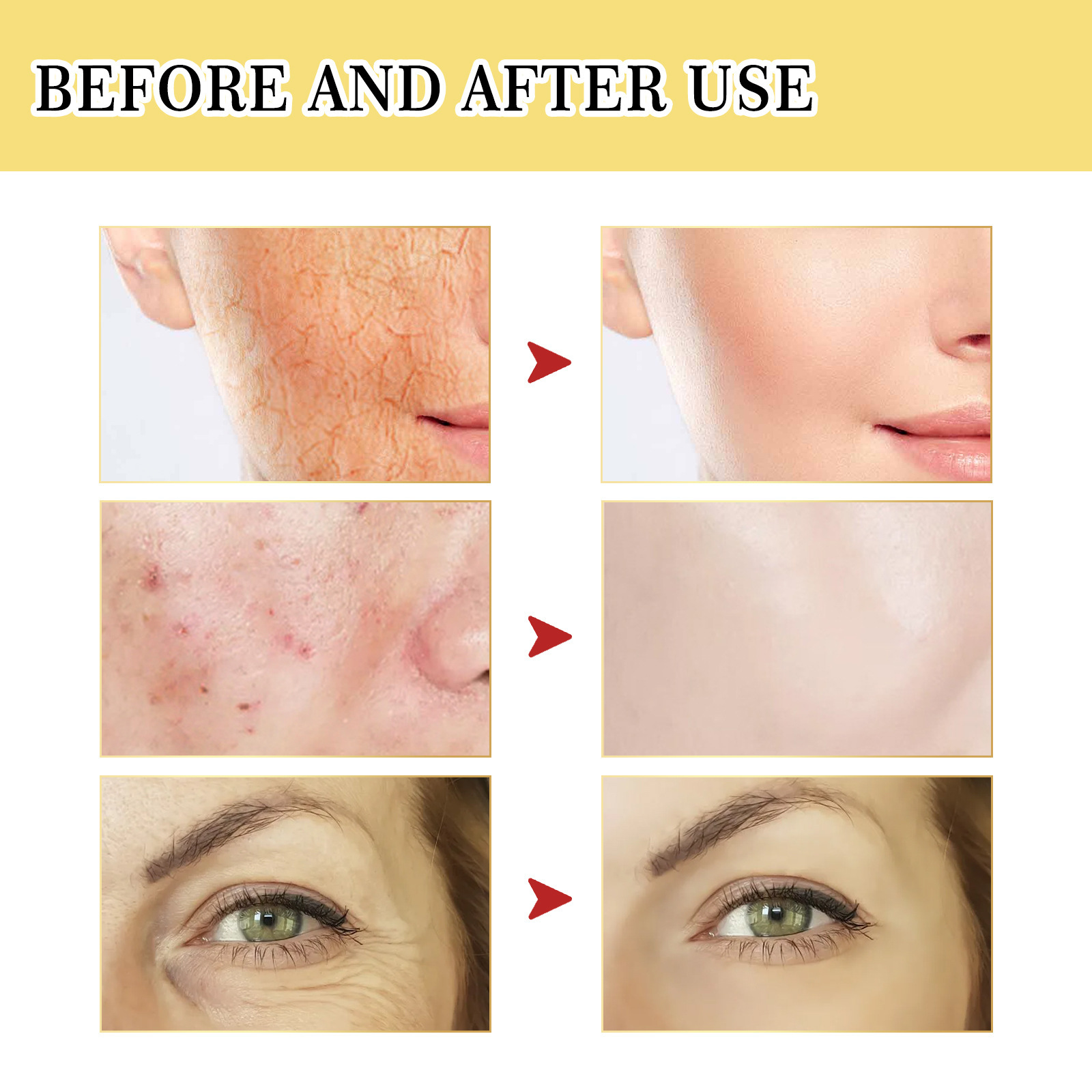 Snail Mucin 96% Repairing Esse - Snail Mucin 96 Repair Essence review and price