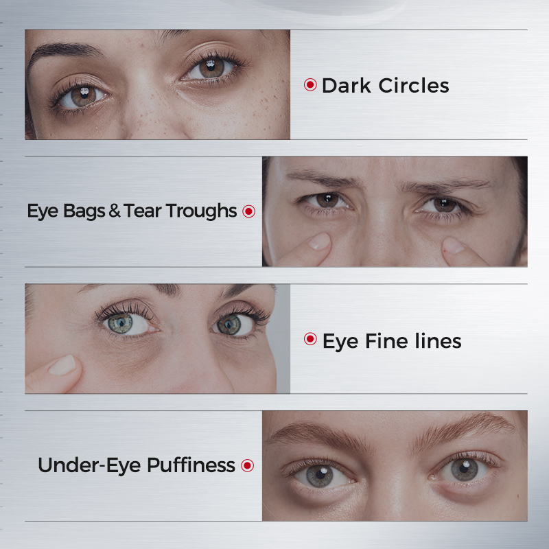 Eye Patches for Dark Circles – - Collagen Under Eye Patches review and price