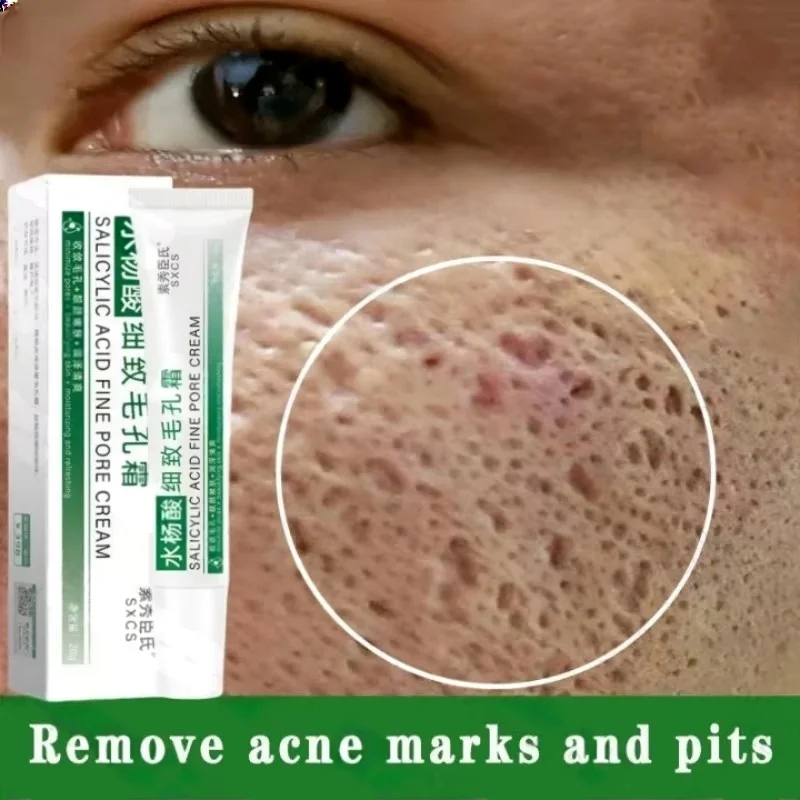 Salicylic Acid Pore Clearing C - Salicylic Acid Blackhead Remover review and price