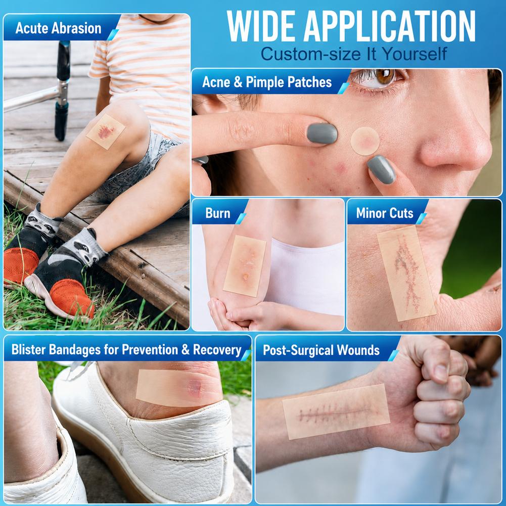 Hydrocolloid Acne Patch Roll 5 - Hydrocolloid Pimple Patch review and price