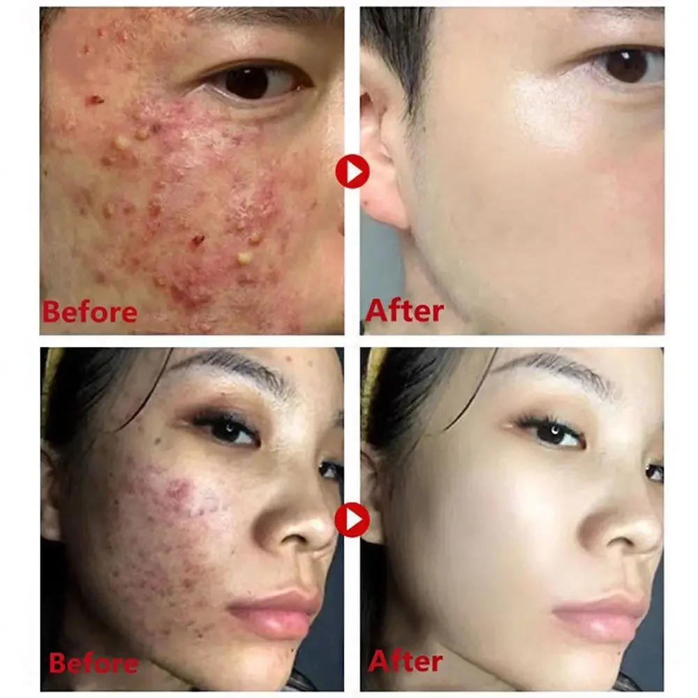 Green Tea Mask Stick Remove Bl - Green Tea Cleansing Clay Mask review and price