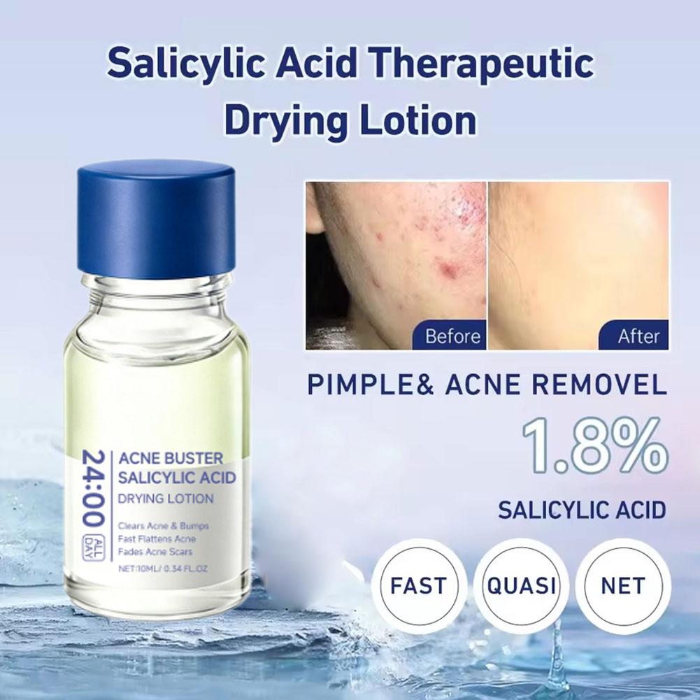 Salicylic Acid Acne Buster Rem - Salicylic Acid Blackhead Remover review and price